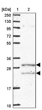 Lane 1: Marker [kDa] 250, 130, 95, 72, 55, 36, 28, 17, 10_br/_Lane 2: Human cell line RT-4