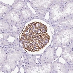 Immunohistochemical staining of human Kidney shows strong membranous positivity in cells in glomeruli.