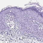 Immunohistochemical staining of human Skin shows no positivity in squamous epithelial cells as expected.