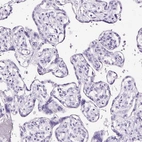 Immunohistochemical staining of human Placenta shows no positivity in trophoblastic cells as expected.