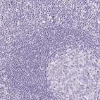 Immunohistochemical staining of human Tonsil shows no positivity in non-germinal center cells as expected.