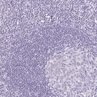 Immunohistochemical staining of human Tonsil shows no positivity in non-germinal center cells as expected.