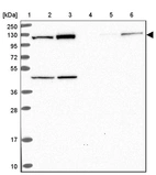 Lane 1: Marker [kDa] 250, 130, 95, 72, 55, 36, 28, 17, 10_br/_Lane 2: Human cell line RT-4_br/_Lane 3: Human cell line U-251 MG_br/_Lane 4: Human plasma_br/_Lane 5: Human Liver tissue_br/_Lane 6: Human Tonsil tissue