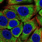 Immunofluorescent staining of human cell line MCF7 shows localization to cytosol.