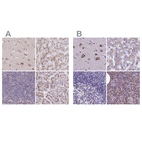 Anti-CASC4 Antibody