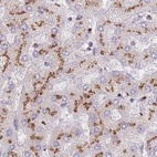 Immunohistochemical staining of human liver using Anti-CASC4 antibody HPA049488.