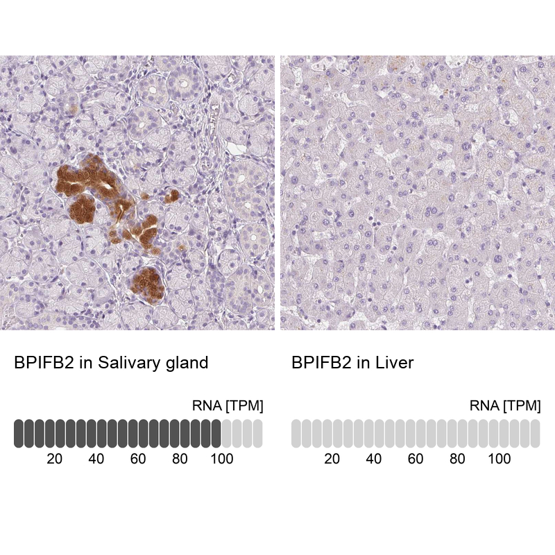 Anti-BPIFB2 Antibody