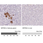Anti-BPIFB2 Antibody