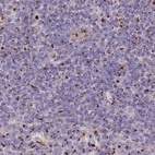 Immunohistochemical staining of human lymph node using Anti-CASC4 antibody HPA049488.