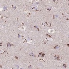 Immunohistochemical staining of human cerebral cortex using Anti-CASC4 antibody HPA049488.