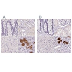 Immunohistochemical staining of human colon, kidney, liver and salivary gland using Anti-BPIFB2 antibody HPA049491 (A) shows similar protein distribution across tissues to independent antibody HPA060121 (B).