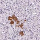 Immunohistochemical staining of human salivary gland shows high expression.