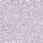 Immunohistochemical staining of human liver shows low expression as expected.