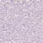 Immunohistochemical staining of human liver shows low expression as expected.