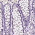 Immunohistochemical staining of human colon using Anti-BPIFB2 antibody HPA049491.