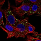 Immunofluorescent staining of human cell line Hep G2 shows localization to vesicles.