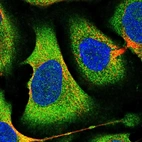Immunofluorescent staining of human cell line U-2 OS shows localization to cytosol.