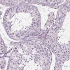 Immunohistochemical staining of human testis shows no positivity in cells in seminiferous ducts as expected.