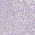 Immunohistochemical staining of human liver shows no positivity in hepatocytes as expected.