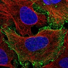 Immunofluorescent staining of human cell line U-2 OS shows localization to plasma membrane & focal adhesion sites.