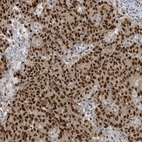 Anti-KLF3 Antibody