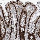 Immunohistochemical staining of human colon shows strong nuclear positivity in glandular cells.