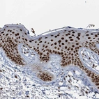 Immunohistochemical staining of human skin shows strong nuclear positivity in squamous epithelial cells.