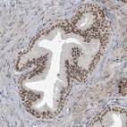 Immunohistochemical staining of human prostate shows moderate nuclear positivity in glandular cells.