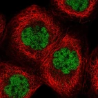 Immunofluorescent staining of human cell line A-431 shows localization to nucleoplasm.