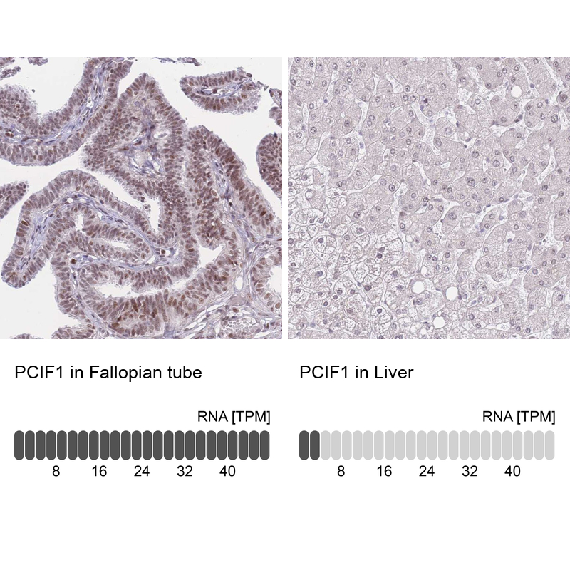 Anti-PCIF1 Antibody