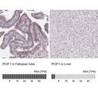 Anti-PCIF1 Antibody