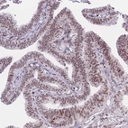 Anti-PCIF1 Antibody