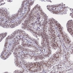 Immunohistochemical staining of human fallopian tube shows high expression.