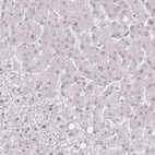 Anti-PCIF1 Antibody