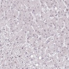 Immunohistochemical staining of human liver shows low expression as expected.