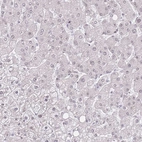 Immunohistochemical staining of human liver shows low expression as expected.