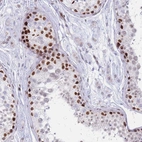 Immunohistochemical staining of human testis shows strong nuclear positivity in a subset of cells in seminiferous ducts.