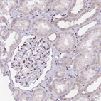 Immunohistochemical staining of human kidney shows strong nuclear positivity in cells in glomeruli.