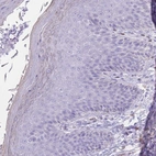 Immunohistochemical staining of human skin shows no positivity in squamous epithelial cells as expected.