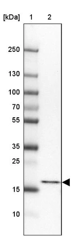 Lane 1: Marker [kDa] 250, 130, 100, 70, 55, 35, 25, 15, 10_br/_Lane 2: Human cell line HepG2