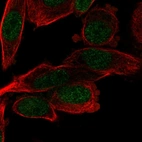 Immunofluorescent staining of human cell line PC-3 shows localization to nucleoplasm.