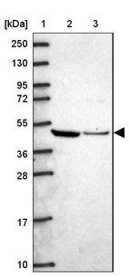 Lane 1: Marker [kDa] 250, 130, 95, 72, 55, 36, 28, 17, 10_br/_Lane 2: Human cell line RT-4_br/_Lane 3: Human cell line U-251MG sp
