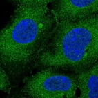 Immunofluorescent staining of human cell line HEK 293 shows localization to plasma membrane & cytosol.
