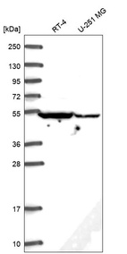 Western blot analysis in human cell line RT-4 and human cell line U-251 MG.