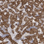 Anti-ASB12 Antibody