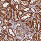 Anti-C6orf203 Antibody