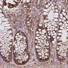 Immunohistochemical staining of human rectum shows strong granular cytoplasmic positivity in cells in tubules.
