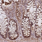 Immunohistochemical staining of human rectum shows strong granular cytoplasmic positivity in cells in tubules.