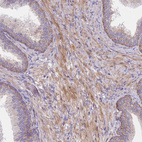 Immunohistochemical staining of human prostate shows moderate granular cytoplasmic positivity in smooth muscle cells.