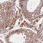 Immunohistochemical staining of human testis shows strong granular cytoplasmic positivity in Leydig cells.